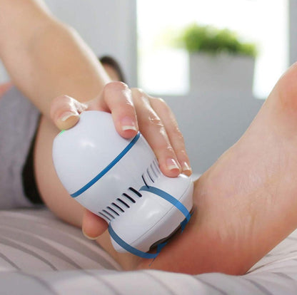 Electric Foot Callus Remover – USB Rechargeable with Vacuum System